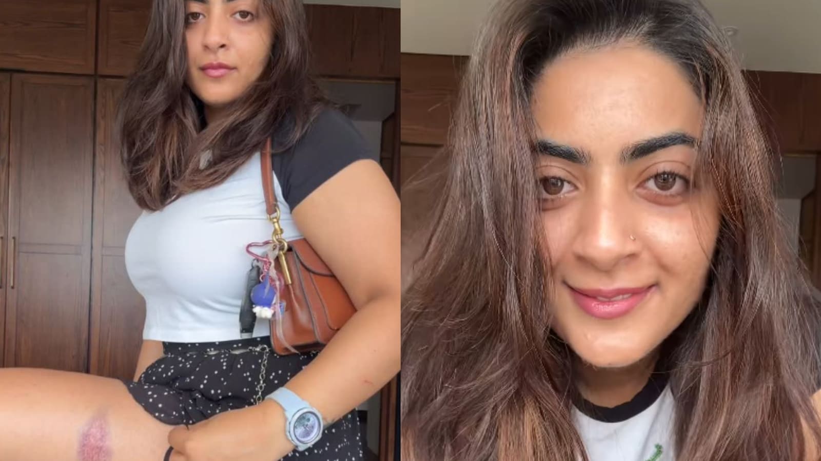 Aamir Khan's Niece Zayn Marie Shares Video Of Injury Marks After Detention During CJP Protest In Mumbai