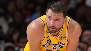 Lakers Fans Worry as Luka Doncic Limps Again During Preseason Game Against Kings