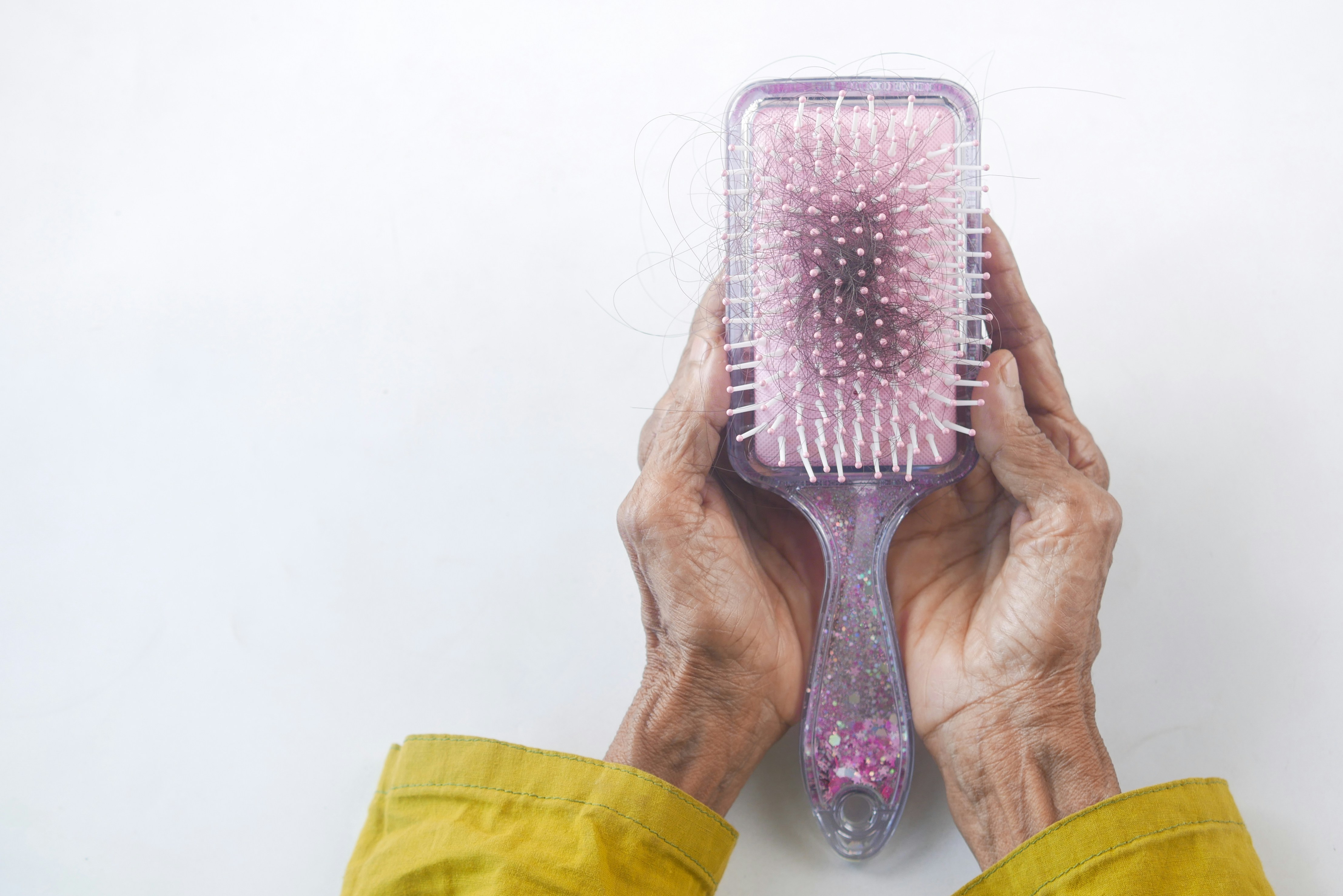 Experts say Hair fall is not one condition, and treating it with one food can mean overlooking the actual cause. Experts say Hair fall is not one condition, and treating it with one food can mean overlooking the actual cause.