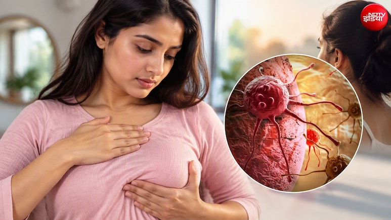 हर मिनट 4 महिलाओं को शिकार बना रहा ब्रेस्ट कैंसर, इन आसान आदतों से टल सकता है बड़ा खतरा
