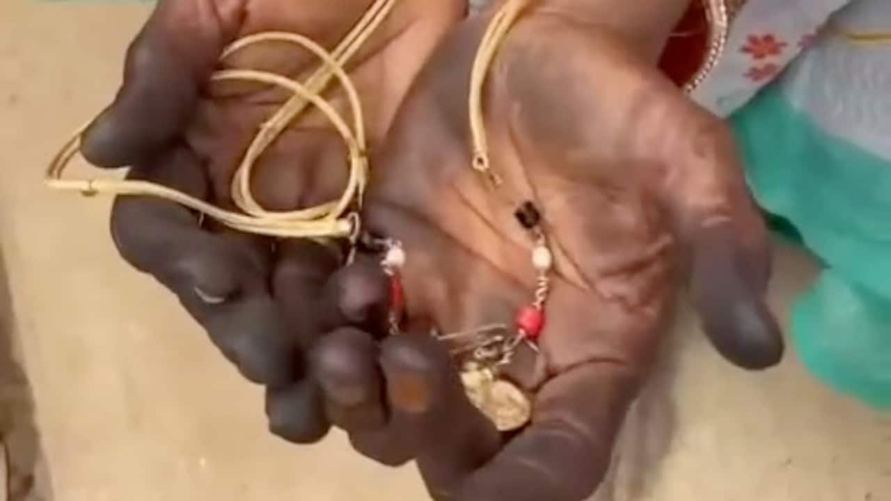 Woman showing her chain that alleged attackers tried to snatch Woman showing her chain that alleged attackers tried to snatch