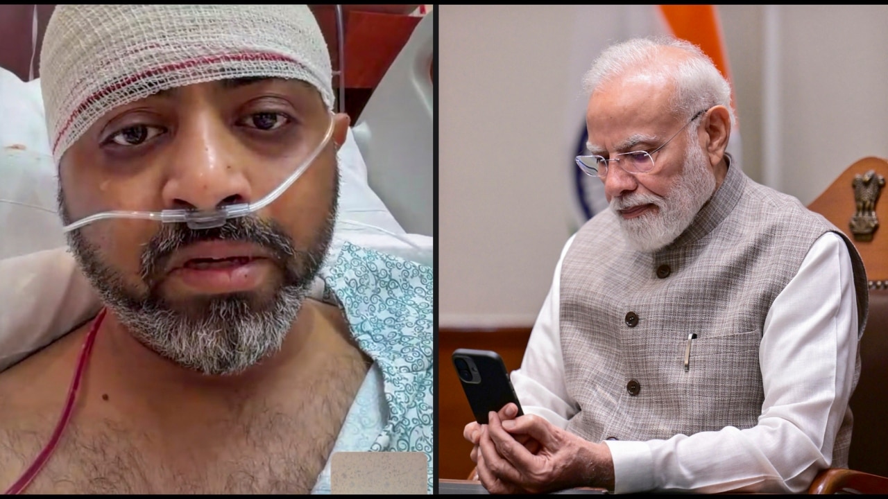 इस हादसे में घायल हुए फ्लाईदुबई के पायलट स्मित मच्छार का दुबई के एक अस्पताल में इलाज चल रहा है. उनसे प्रधानमंत्री नरेंद्र मोदी ने बातचीत की थी.