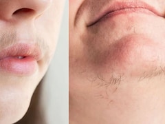 Upper Lips या ठुड्डी पर ज्यादा बाल आते हैं तो क्या करें? सेलिब्रिटी न्यूट्रिशनिस्ट ने बताया चेहरे के बाल कम करने का असरदार नुस्खा
