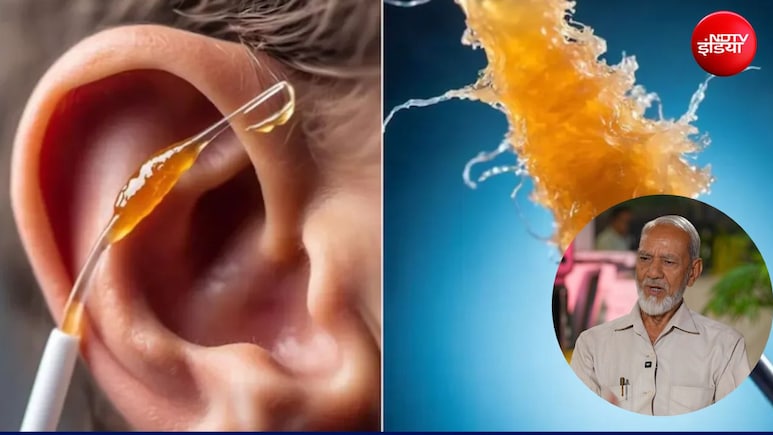 कान का मैल कैसे साफ करें? यूनानी डॉक्टर ने बताए सुरक्षित घरेलू उपाय