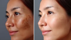 सोने से पहले चेहरे पर लगाएं ये देसी चीजें, सुबह दिखेगा नेचुरल ग्लो, शहनाज हुसैन ने बताए फायदे