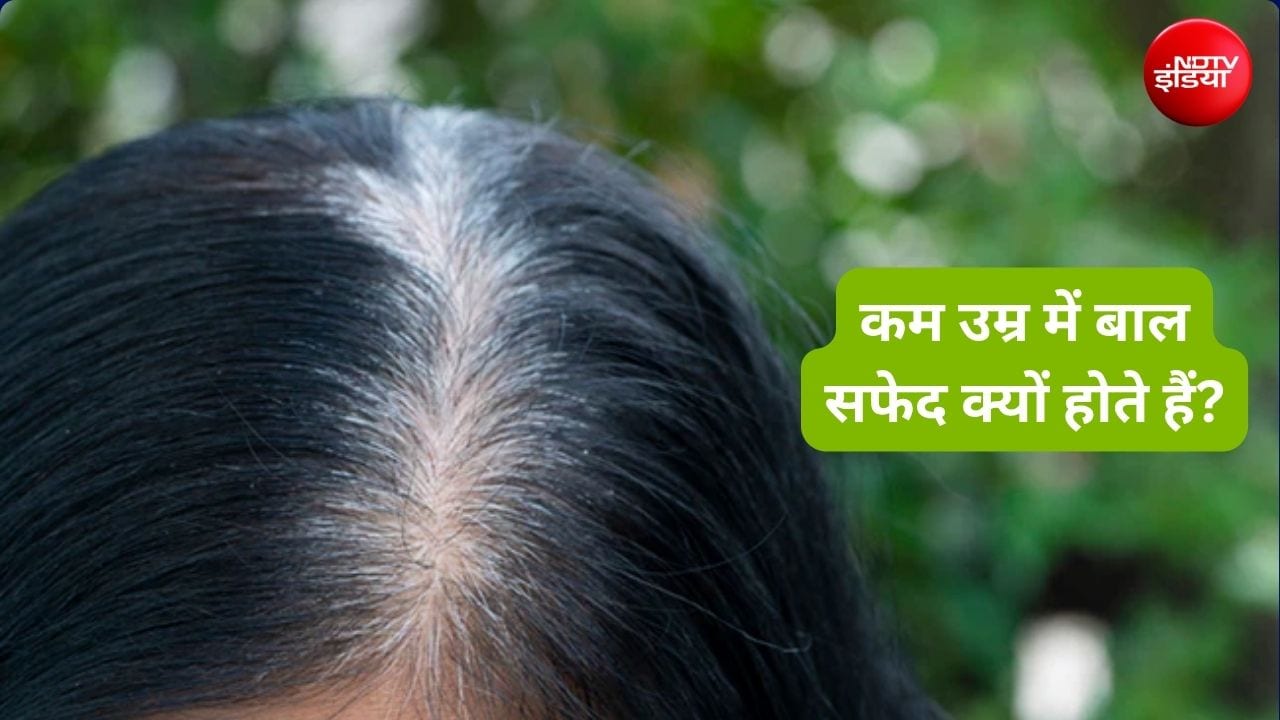 सफेद बालों को काला कैसे करें, यूनानी एक्‍सपर्ट ने बताए आंवला और करी पत्ता के घरेलू उपाय