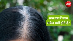 सफेद बालों को काला कैसे करें, यूनानी एक्‍सपर्ट ने बताए आंवला और करी पत्ता के घरेलू उपाय