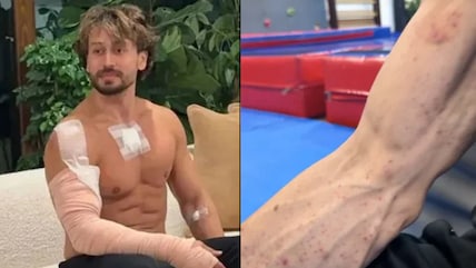 Tiger Shroff Shares Arm Injury Video As Firing Probe Widens