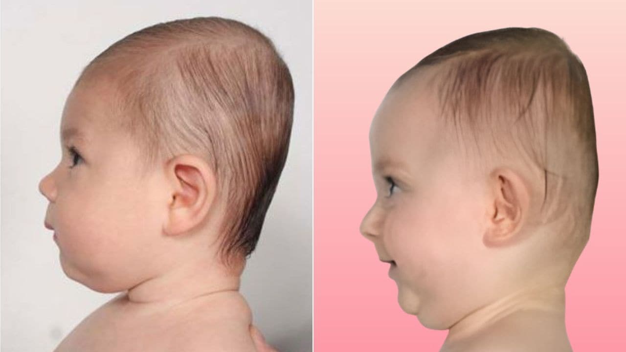 छोटे बच्चे का सिर चपटा होने से कैसे बचाएं? Parenting Expert ने बताया इन 5 बातों पर जरूर दें ध्यान