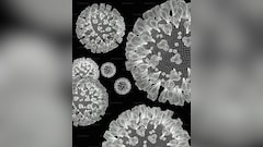 France Reports First Ever Human Case Of Shamonda Virus: Public Risk, Symptoms Explained