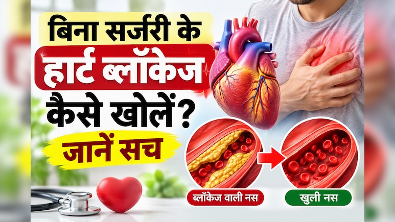 नीबू-अदरक का पानी पीने से खुल जाती हैं दिल की नसें? डॉक्टर से समझें बिना सर्जरी कैसे ठीक होता है ब्लॉकेज