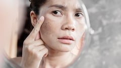 टैनिंग या काले धब्बे? कैसे जानें स्किन की असली समस्या क्या है