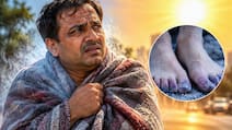 किस व‍िटााम‍िन की कम से लगती है ज्‍यादा ठंड? बदलते मौसम से पहले जान लें बचाव के तरीके