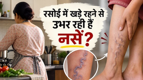 रसोई में खड़े खड़े सूज रहे हैं पैर? नीली नसों को सिर्फ दिनभर की थकान समझने की भूल मत कीजिए