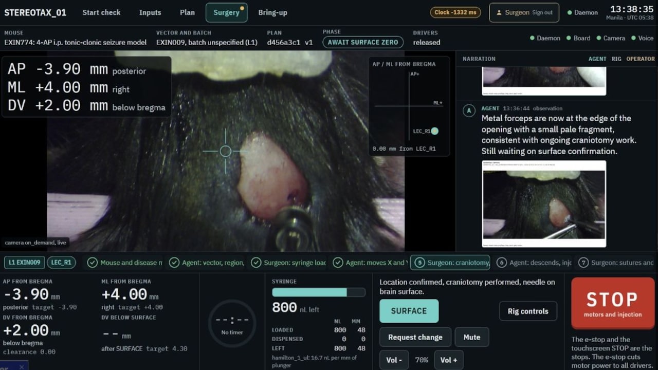 An AI Agent Just Performed A Brain Operation