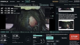 An AI Agent Just Performed A Brain Operation