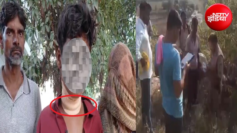 तुम्हारी बलि दूंगा; ये कहकर 14 साल के बच्चे पर 9 बार चाकू से हमला, मरा समझकर ग्वालियर के जंगल में छोड़ा
