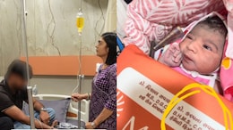 ICU में BHMS डॉक्टर की मौजूदगी पर क्यों मचा विवाद? सूरत के हॉस्पिटल को लेकर डॉक्टर समुदाय ने उठाए सवाल