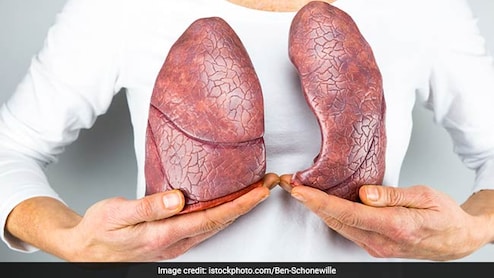 Early Signs Of Lung Cancer: Don't Ignore These Subtle Alerts Of A Deadly Risk