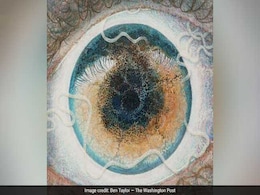 An Artist Found A Parasitic Worm In His Eye - And Turned It Into Art An Artist Found A Parasitic Worm In His Eye - And Turned It Into Art