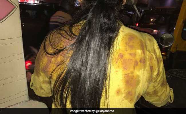 मुंबई : गुटखा खाकर महिला के ऊपर थूका, ट्वीट करके शिकायत की