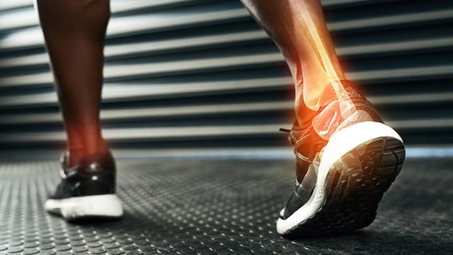 Obesity and smoking are linked with poor bones health