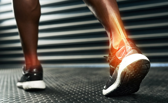 Obesity and smoking are linked with poor bones health