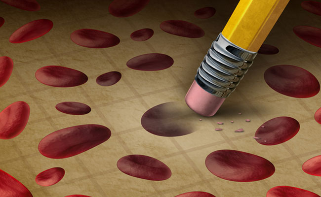 Thalassemia is an inherited disease characterised by faulty haemoglobin synthesis and RBC production