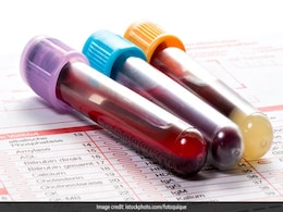 This Blood Test May Predict Onset Of Tuberculosis This Blood Test May Predict Onset Of Tuberculosis