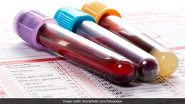 Preventive Screenings For Men: Gynaecologist Shares Complete List Of Essential Health Tests