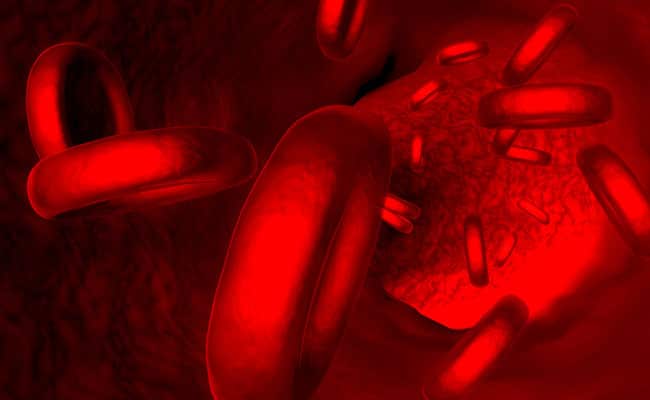 IIT Researchers Identity New Function Of Protein To Help Treat Sepsis