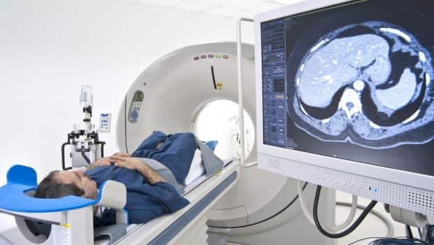 दिमाग के लिए खतरनाक साबित हो सकता है स्मोकिंग और डायबिटीज...