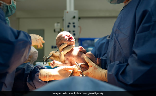 प्राइवेट अस्पतालों में बढ़े ऑपरेशन से प्रसव, दिल्ली समेत 18  राज्यों का ये हाल, NFHS की रिपोर्ट से ख़ुलासा