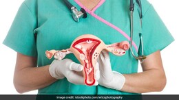 Signs And Symptoms Of Cervical Cancer