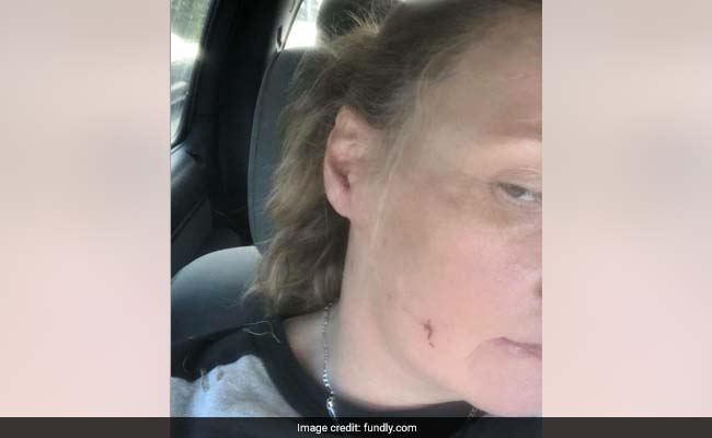 "It Was Either Me Or The Cat": US Woman Kills Rabid Bobcat With Bare Hands