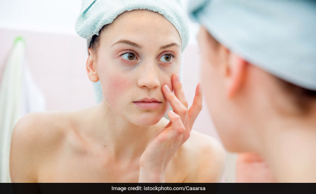 6 Signs That You Might Have Sensitive Skin