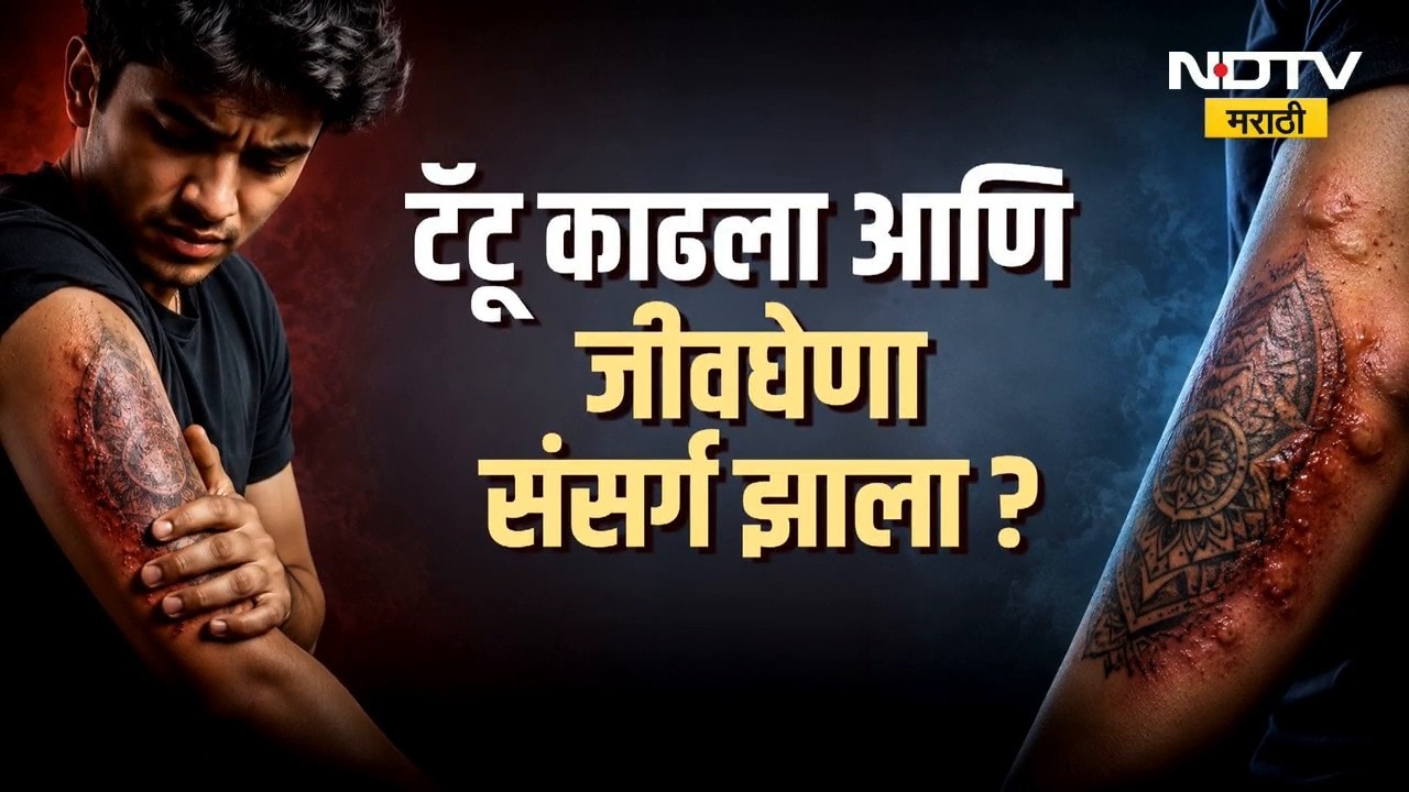 Global Report | टॅटू काढला आणि HIV झाला, कानपूरमध्ये काय घडलं? पाहा रिपोर्ट