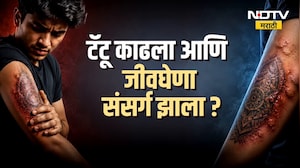 Global Report | टॅटू काढला आणि HIV झाला, कानपूरमध्ये काय घडलं? पाहा रिपोर्ट