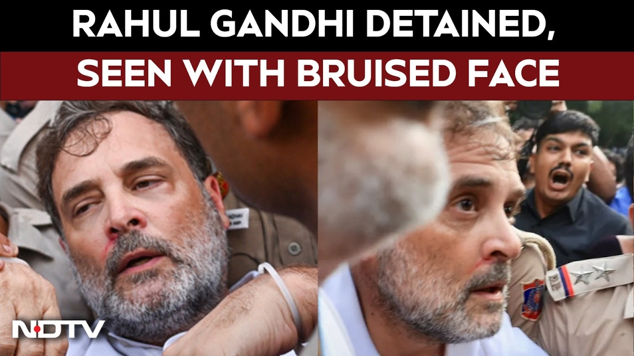 Rahul Gandhi Detained From Protest Site, Seen With Bruised Face