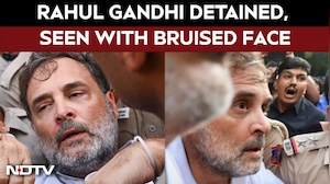 Rahul Gandhi Detained From Protest Site, Seen With Bruised Face