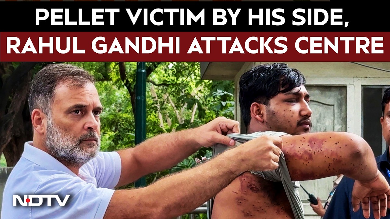 Pellet Gun | "Stop Lying": Pellet Victim By His Side, Rahul Gandhi Targets Centre | Rahul Gandhi