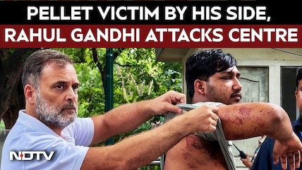 "Stop Lying": Pellet Victim By His Side, Rahul Gandhi Targets Centre | Rahul Gandhi