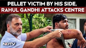 "Stop Lying": Pellet Victim By His Side, Rahul Gandhi Targets Centre | Rahul Gandhi