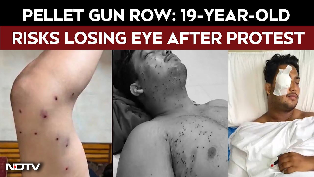Pellet Gun Row Escalates: 19-Year-Old Risks Losing Eye After Protest