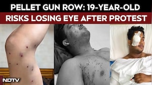 Pellet Gun Row Escalates: 19-Year-Old Risks Losing Eye After Protest