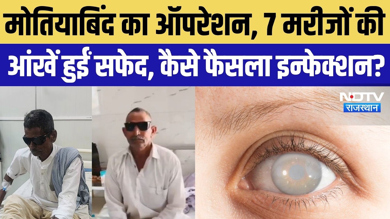 Kuchaman Cataract Surgery Case: मोतियाबिंद ऑपरेशन, 7 मरीजों की आंखें सफेद, इन्फेक्शन या लापरवाही?
