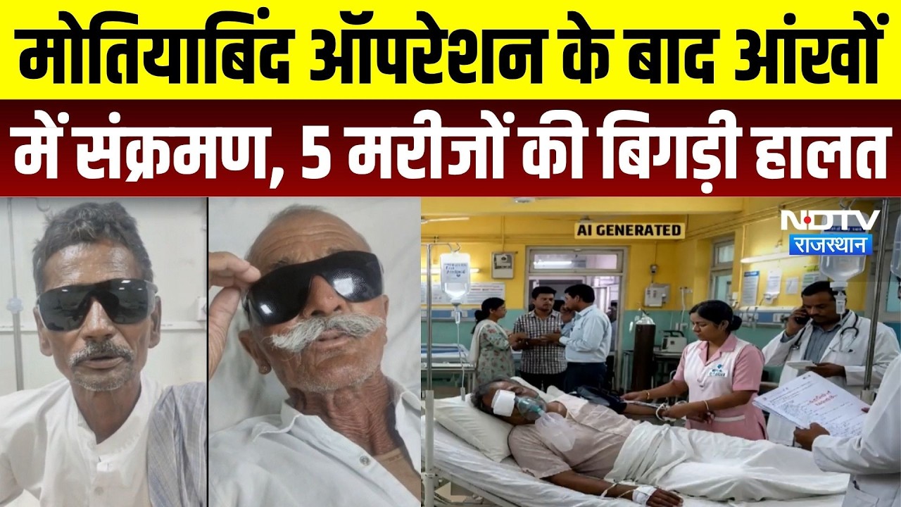Kuchaman Cataract Surgery Case: मोतियाबिंद ऑपरेशन के बाद आंखों में संक्रमण, 5 मरीजों की बिगड़ी हालत