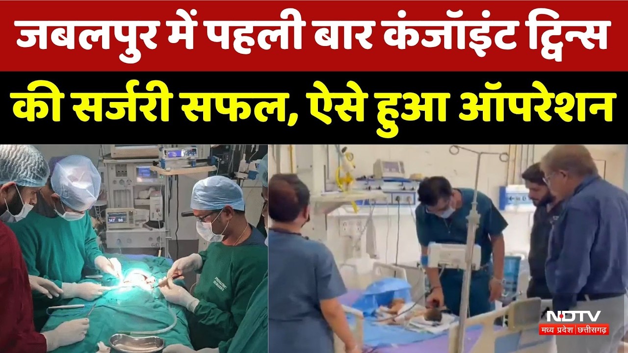 Jabalpur Conjoined Twins Surgery: पहली बार कंजॉइंट ट्विन्स की सर्जरी सफल, ऐसे हुआ ऑपरेशन | MP