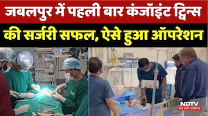 Jabalpur Conjoined Twins Surgery: पहली बार कंजॉइंट ट्विन्स की सर्जरी सफल, ऐसे हुआ ऑपरेशन | MP
