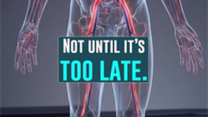 Preventing Heart Disease Without A Scalpel